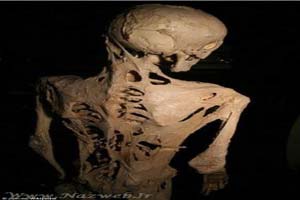 دختر زنده ای که به اسکلت تبدیل می شوند + عکس