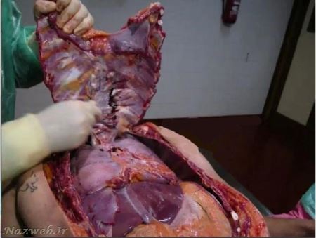 18+ تصاویری از کالبد شکافی بدن زنان و مردان سری اول