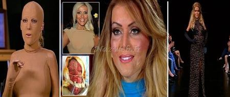 عکس های تکان دهنده از جراحی صورت سوخته یک زن