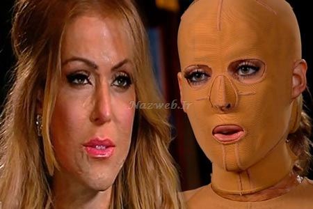 عکس های تکان دهنده از جراحی صورت سوخته یک زن