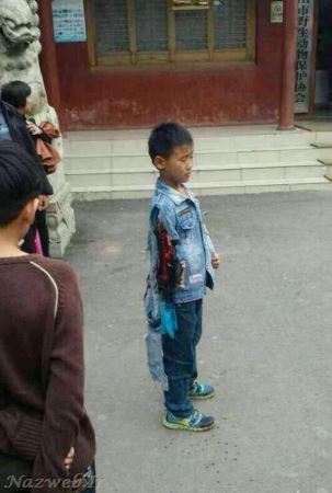 تصاویر تکان دهنده از قطع دست پسربچه ای توسط یک خرس