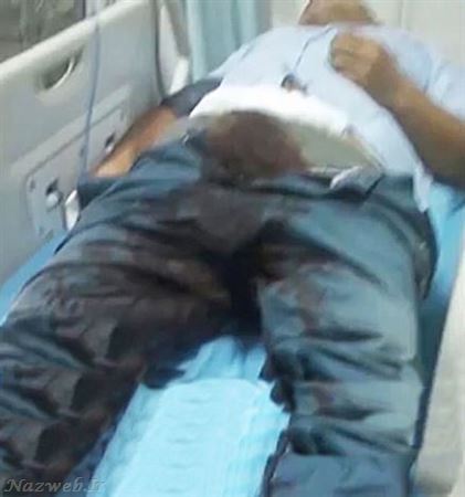 مردی که آلت تناسلی خود را تکه تکه کرد + عکس 16+