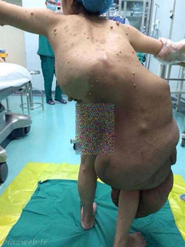  خانم جوان با وحشتناک ترین اندام دنیا + عکس 16+