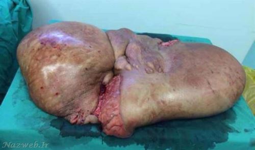  خانم جوان با وحشتناک ترین اندام دنیا + عکس 16+