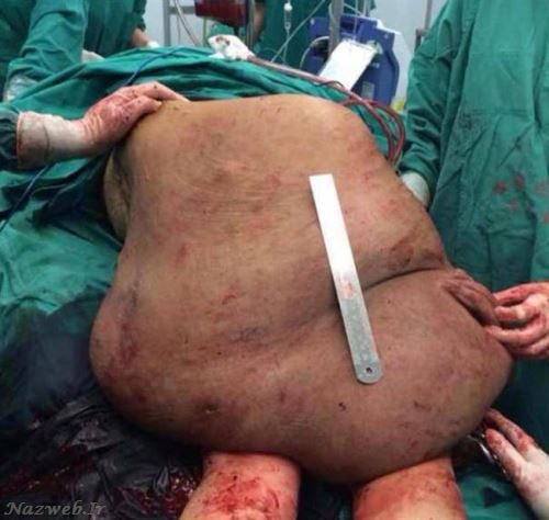  خانم جوان با وحشتناک ترین اندام دنیا + عکس 16+