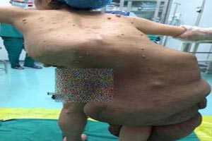 خانم جوان با وحشتناک ترین اندام دنیا + عکس 16+ خانم جوان با وحشتناک ترین اندام دنیا + عکس 16+