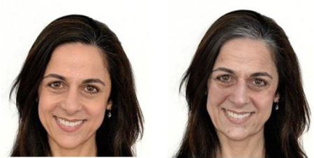 استرس و اثرات آن بر روی چهره + مقایسه تصاویر