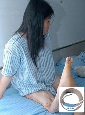 خارق العاده و ترسناک از بروز اتفاق برای این دختر + عکس خارق العاده و ترسناک از بروز اتفاق برای این دختر + عکس