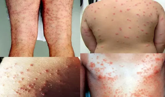 آیا می دانید حلزون ها از کوسه ها برای انسان مرگبارترند!؟