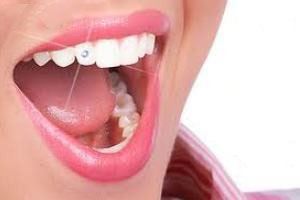 پیرسینگ یا سوراخ کردن پوست چه عوارضی دارد + عکس