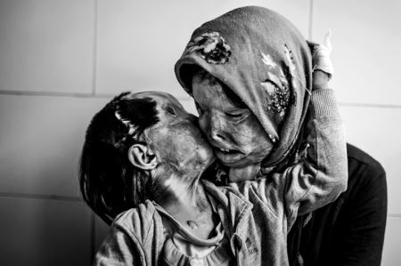 (+18) عکس هایی که یک دنیا درد دارند