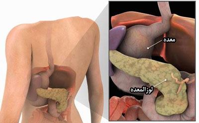 نشانه های بیماری لوزالمعده (عکس)