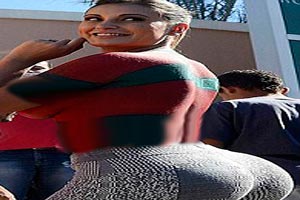 تکان دهنده از تزریق ژل به ران های ملکه زیبایی برزیل (18+) تکان دهنده از تزریق ژل به ران های ملکه زیبایی برزیل (18+)