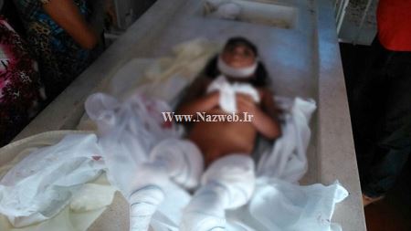 18+ دختری که زنده زنده توسط این ماهی خورده شد (عکس)