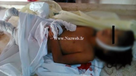 18+ دختری که زنده زنده توسط این ماهی خورده شد (عکس)