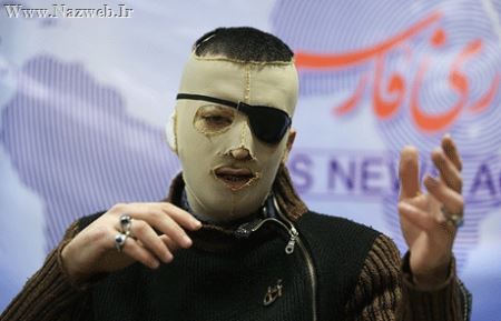 +16 ناگفته های دردناک پسر جوان قربانی اسید پاشی (تصاویر)
