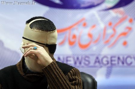 +16 ناگفته های دردناک پسر جوان قربانی اسید پاشی (تصاویر)
