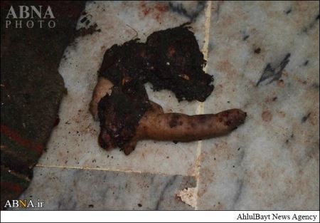 بمب گذاری درمسجد، دیدن این تصاویر وحشتناک به همه توصیه نمیشود