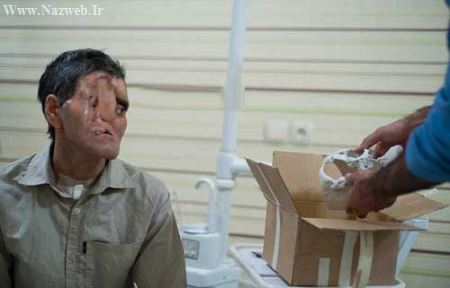 بزرگترین عمل زیبایی صورت و عجیب در ایران (تصاویر)