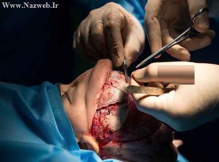 بازسازی جمجمه این دختر در ایران (تصاویر 18+)
