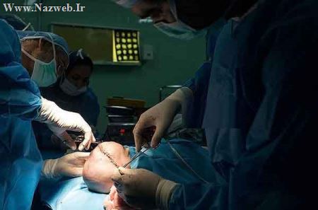 بازسازی جمجمه این دختر در ایران (تصاویر 18+)
