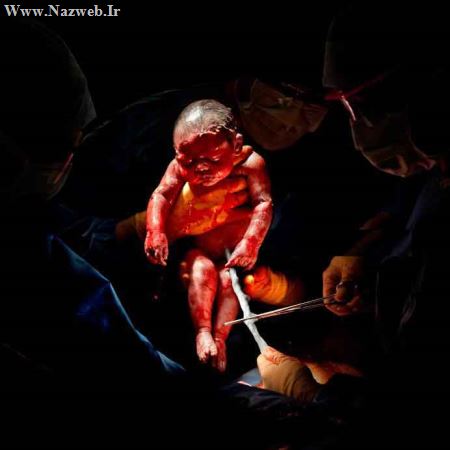 تصاویردیدنی از 20 ثانیه اول زایمان تا بریدن بند ناف