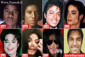 چهره های باورنکردنی مایکل جکسون قبل و بعد از عمل زیبایی