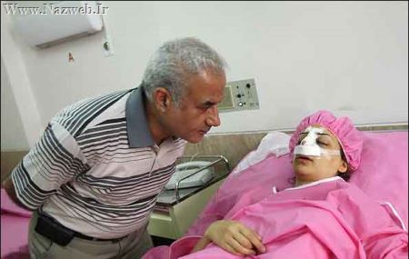 تصاویری از عمل جراحی زیبایی دماغ (18+)