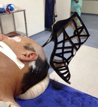 پاشنه کفش زنی که در سر شوهرش جا ماند! ( عکس)