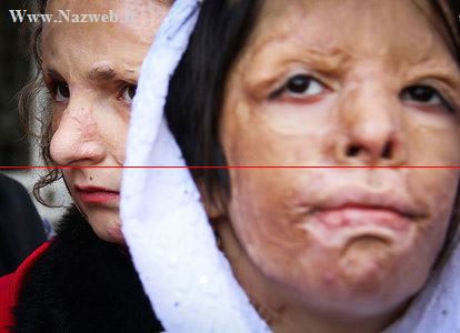 شما دلتان بحال چهره های وحشتناک دختران شین آباد نمی سوزد (تصاویر)