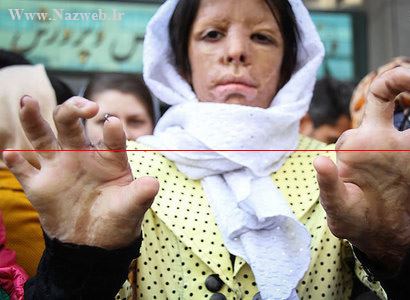 شما دلتان بحال چهره های وحشتناک دختران شین آباد نمی سوزد (تصاویر)