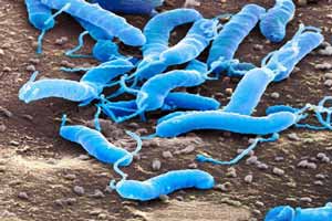 بیماری هلیکو باکتر پیلوری چیست