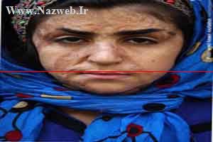 شما دلتان بحال چهره های وحشتناک دختران شین آباد نمی سوزد (تصاویر) شما دلتان بحال چهره های وحشتناک دختران شین آباد نمی سوزد (تصاویر)