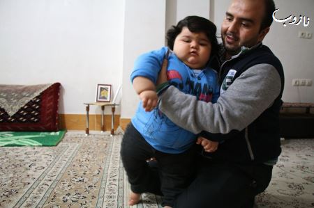 پسر 1 ساله بجنوردی با 42 کیلو وزن !(عکس)