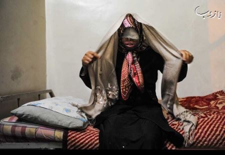 (18-) سمیه مهری قربانی اسید پاشی درگذشت (عکسهای دردناک)