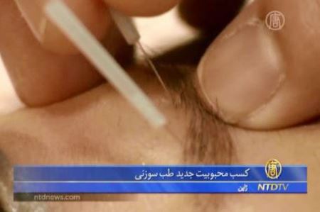 جوانسازی چینی پوست صورت و ... افزایش حجم لب (عکس)