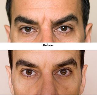 جوانسازی چینی پوست صورت و ... افزایش حجم لب (عکس)