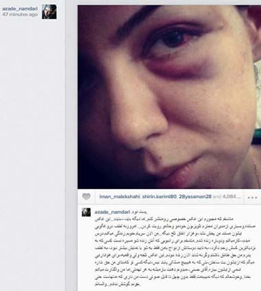 ماجرای تازه و جنجالی کبودی نامداری و حسنی (عکس)