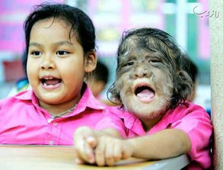 عکس هایی از انسان های ناقص الخلقه (18-)