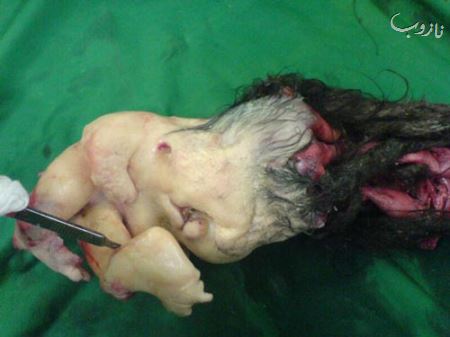 عکس هایی از انسان های ناقص الخلقه (18-)