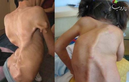 عکس هایی از انسان های ناقص الخلقه (18-)