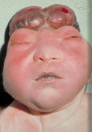 عکس هایی از انسان های ناقص الخلقه (18-)