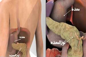 سرطان لوزالمعده چه نشانه هایی دارد