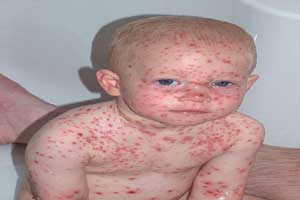 مرگبارترین سلاح های زیستی دنیا سری اول مرگبارترین سلاح های زیستی دنیا سری اول