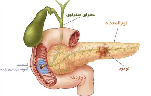 اعضایی از بدن که نبود آن ها انسان باز هم سلامت است!