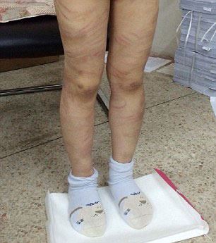 (16+) تنبیه وحشتناک با میله آهنی و لوله (عکس)