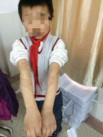 (16+) تنبیه وحشتناک با میله آهنی و لوله (عکس)