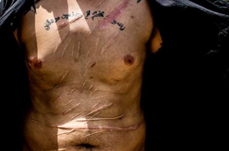 (16 +) بدن های خط خطی و وحشتناک اراذل و اوباش تهران (عکس)
