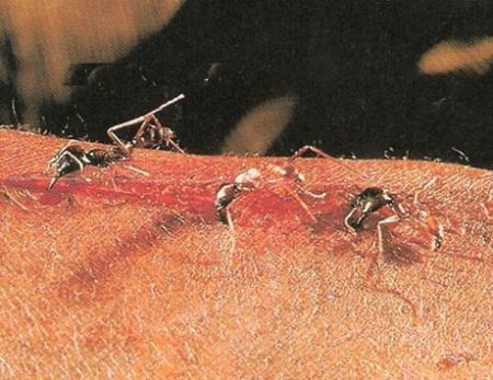 حیرت انگیز از مورچه های جراح که زخم را بخیه می زنند ! عکس