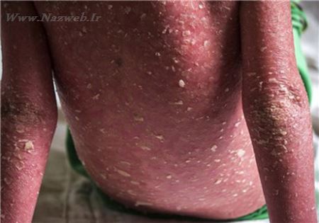 دختر جنجالی ایرانی که خون از بدنش جاری می شود (18- عکس)